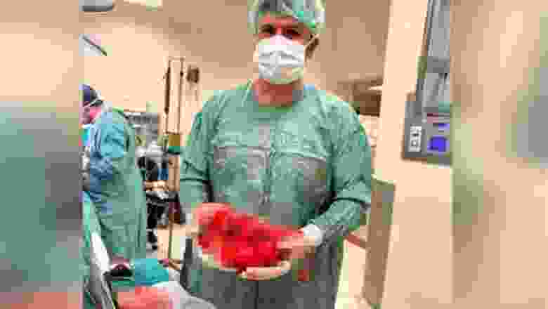 Şanlıurfa'da bir hastanın karnından 5 kilogramlık böbrek tümörü çıkarıldı