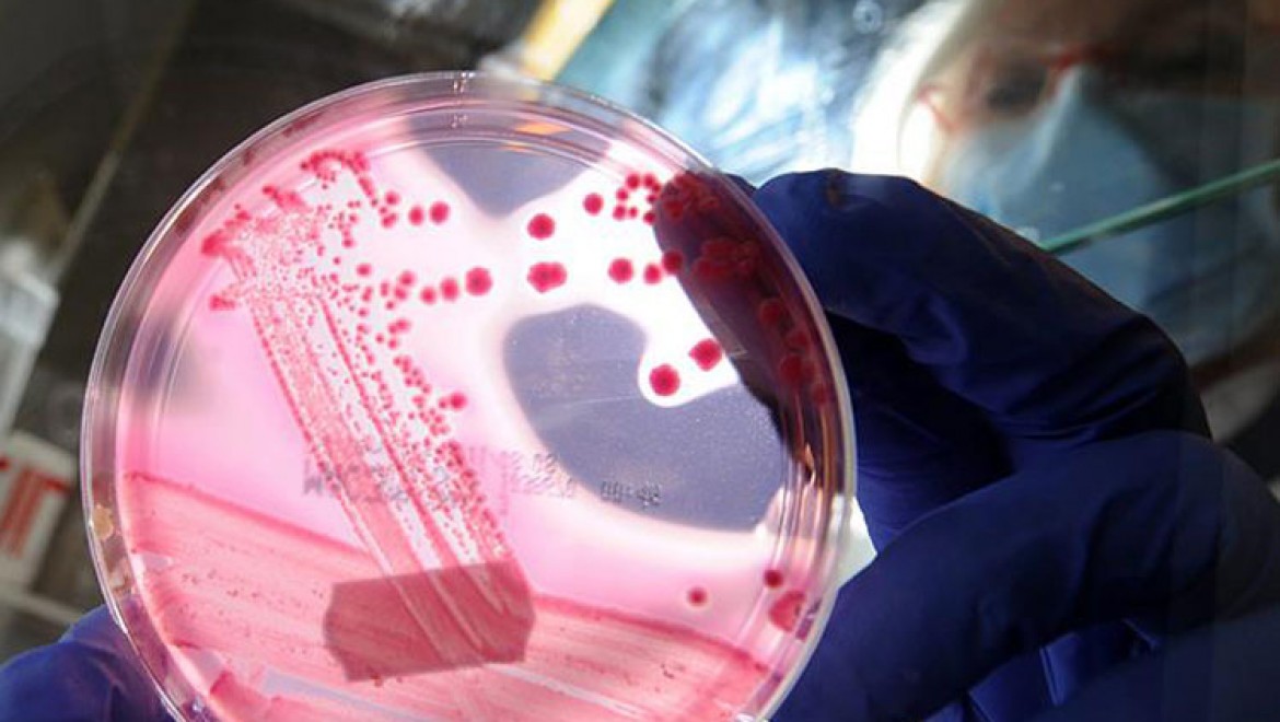 Bakterilerin antibiyotik direncini kırmanın yolu bulundu