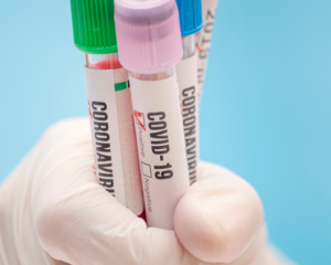 Koronavirüs Teşhisi İçin Hangi Testler Uygulanıyor ve Testler Nasıl Yapılıyor?