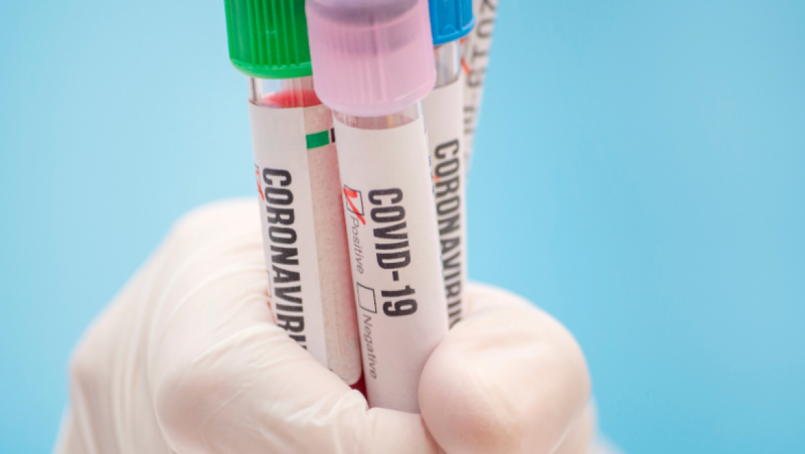 Koronavirüs Teşhisi İçin Hangi Testler Uygulanıyor ve Testler Nasıl Yapılıyor?